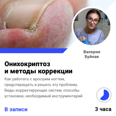 Запись вебинара Онихокриптоз и методы коррекции (2 часа)